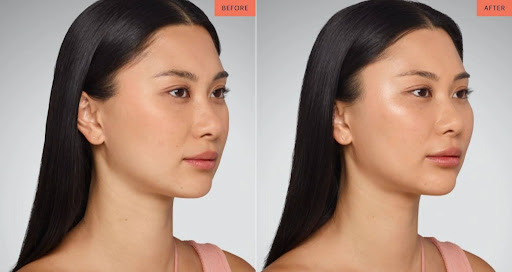 The Facial Areas That Age Faster From Stress and Poor Sleep