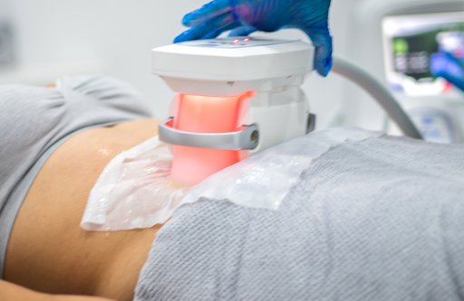 Unlock the Benefits of Fat Freezing Treatment with Elite Body Contouring